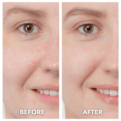 NovaLift™ 5 in 1 Cleanser & Revitalizer