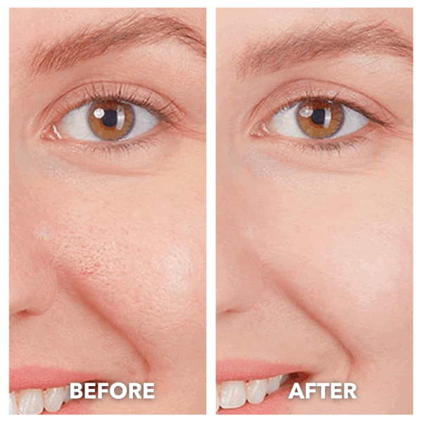 NovaLift™ 5 in 1 Cleanser & Revitalizer