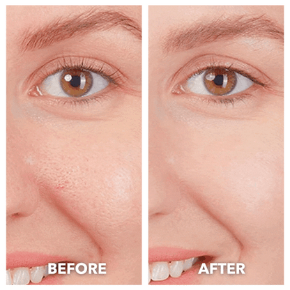 NovaLift™ 5 in 1 Cleanser & Revitalizer